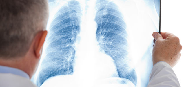 Lung cancer medicine