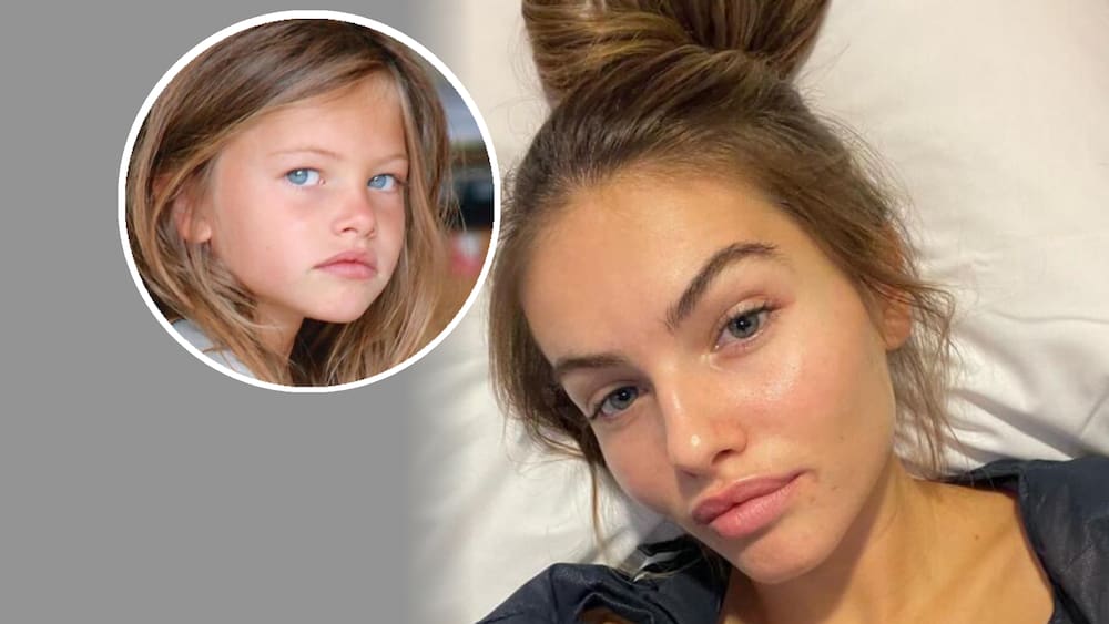 Thylane Blondeau, the most beautiful girl in the world, had to undergo emergency surgery